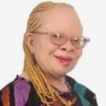 Albinism Association calls for inclusion of skin screening, treatment into NHIS