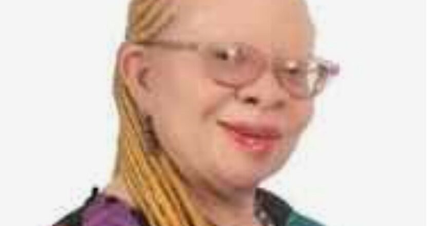 Albinism Association calls for inclusion of skin screening, treatment into NHIS