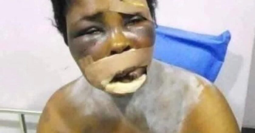 How my Yahoo son wanted to remove my eyes for r!tual…Delta mum laments.